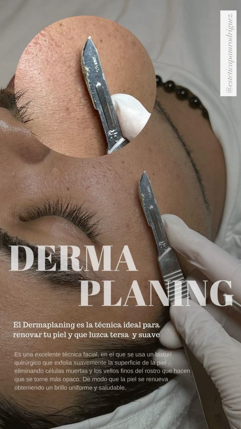 Trabajo realizado en Estética Pamela Rodriguez 13