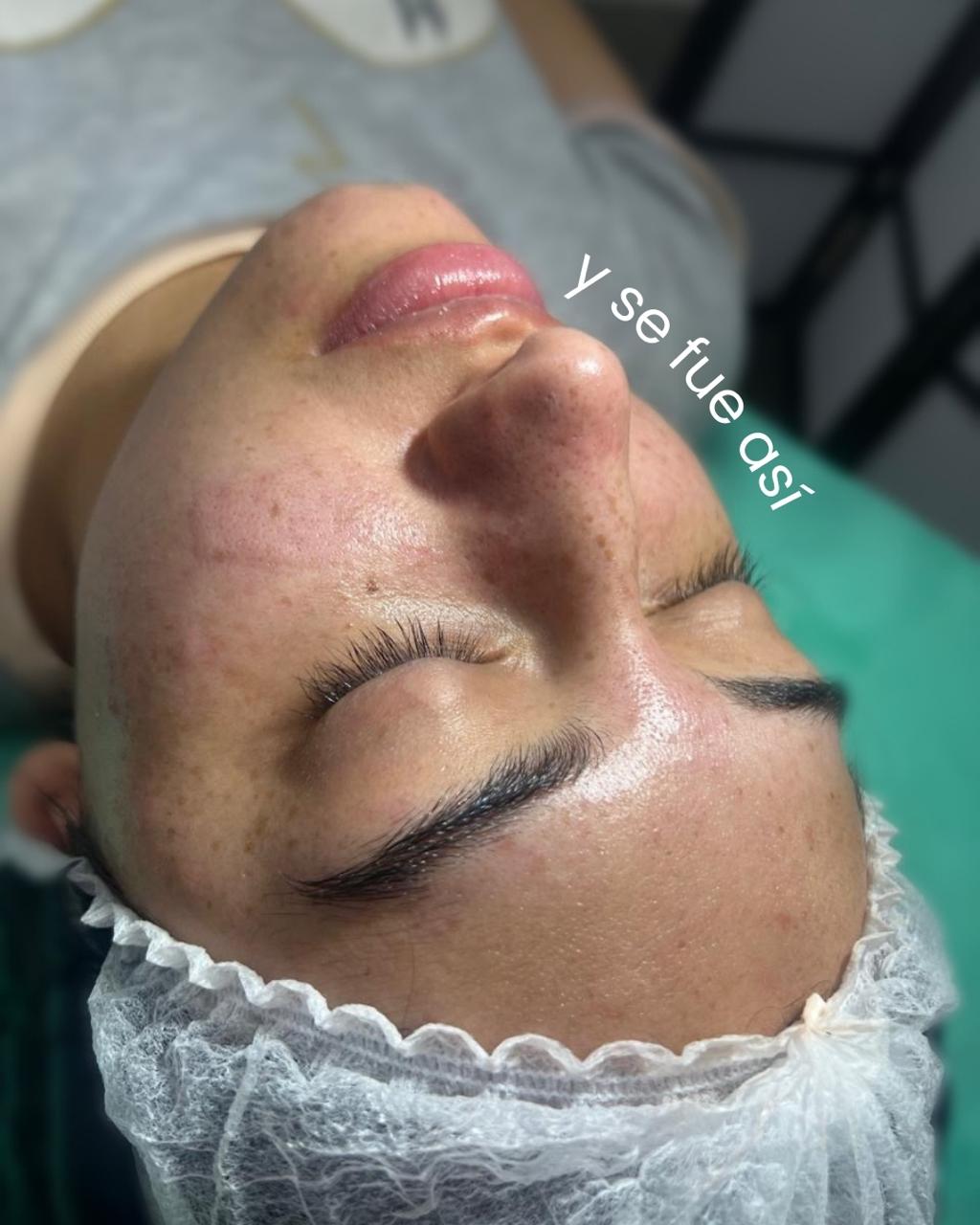 Trabajo realizado en Estética Pamela Rodriguez 20