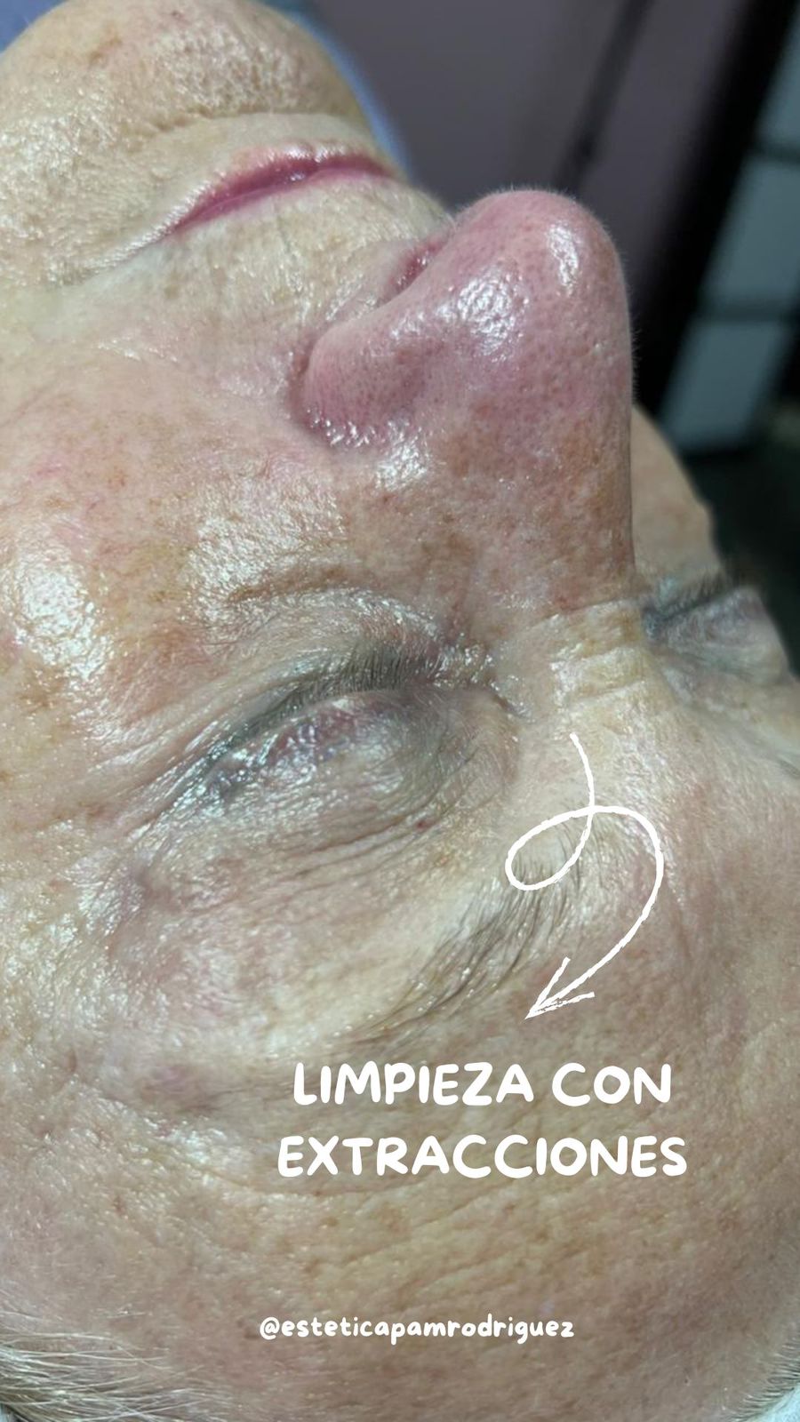 Trabajo realizado en Estética Pamela Rodriguez 21