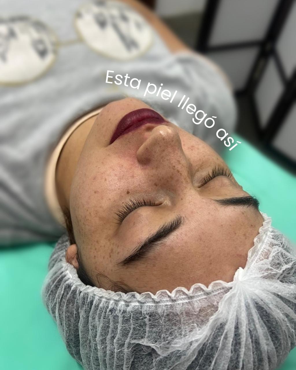 Trabajo realizado en Estética Pamela Rodriguez 22