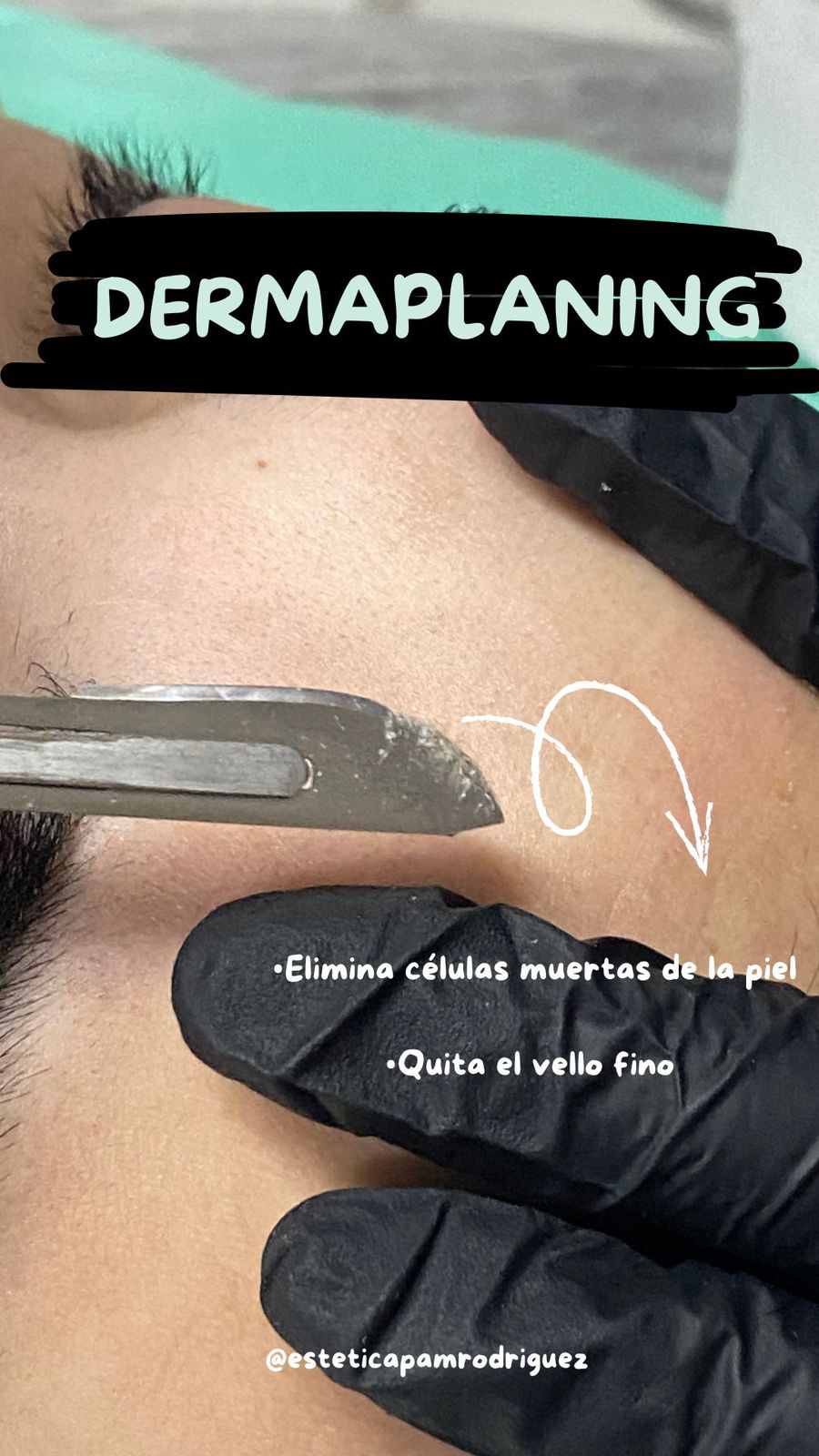 Trabajo realizado en Estética Pamela Rodriguez 23