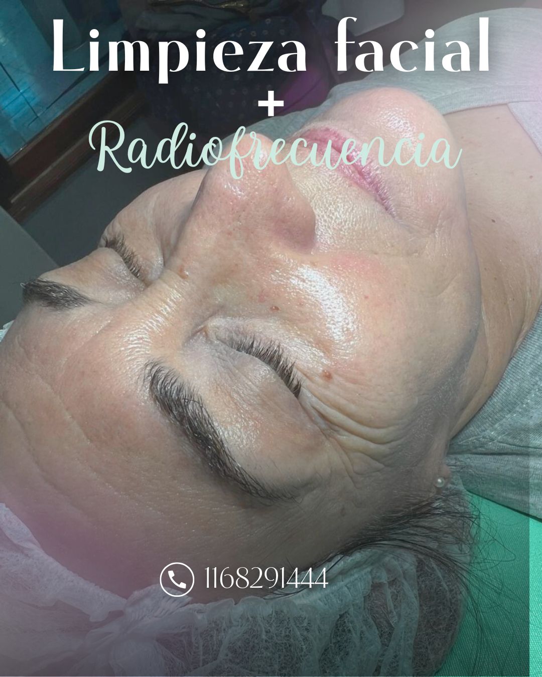 Trabajo realizado en Estética Pamela Rodriguez 25