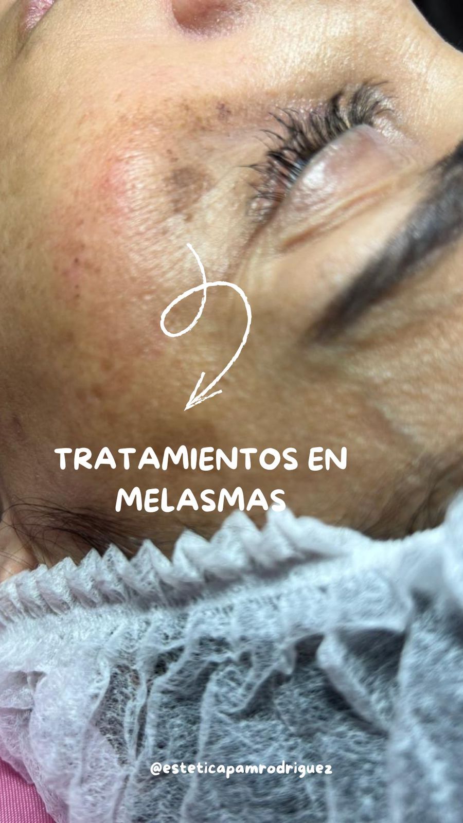 Trabajo realizado en Estética Pamela Rodriguez 26