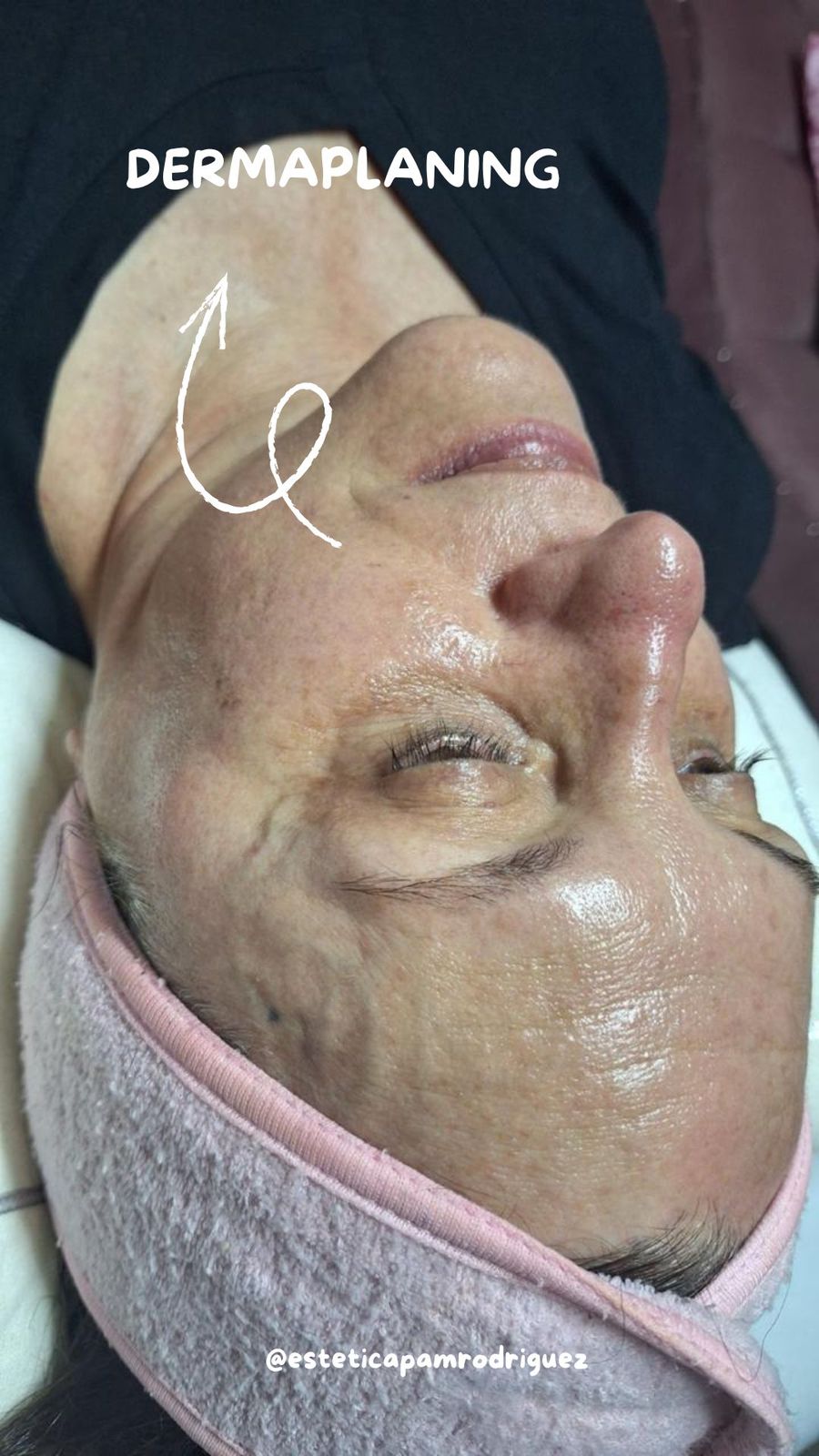 Trabajo realizado en Estética Pamela Rodriguez 28