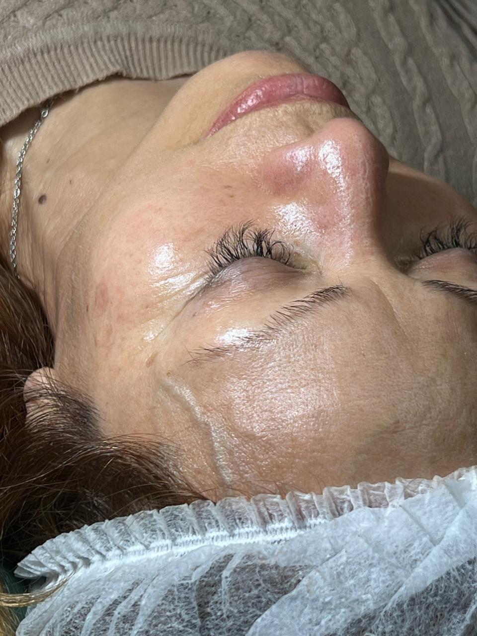 Trabajo realizado en Estética Pamela Rodriguez 29