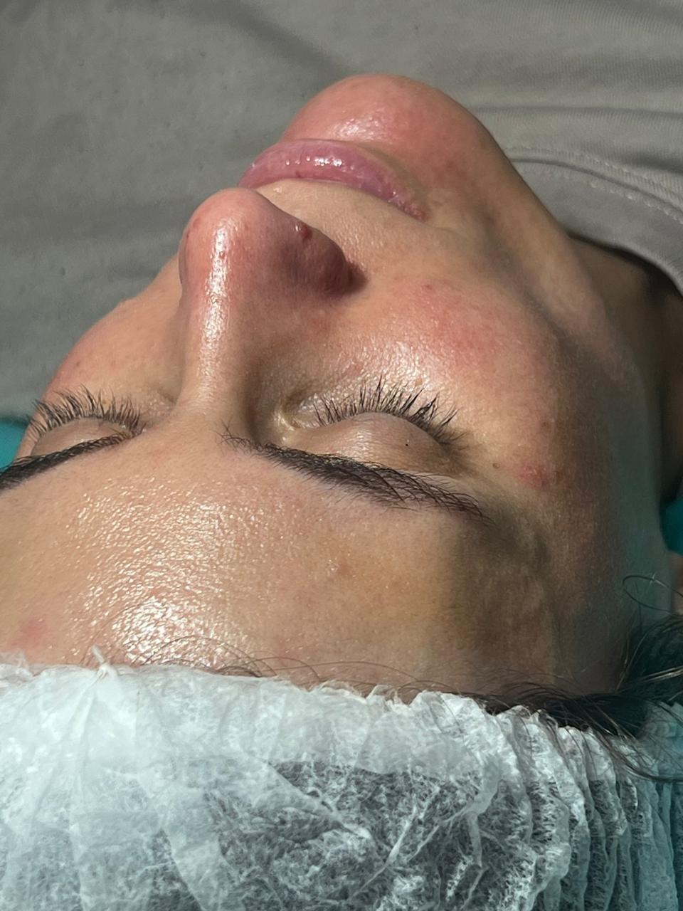 Trabajo realizado en Estética Pamela Rodriguez 30
