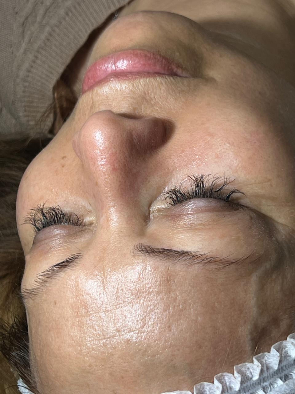 Trabajo realizado en Estética Pamela Rodriguez 32