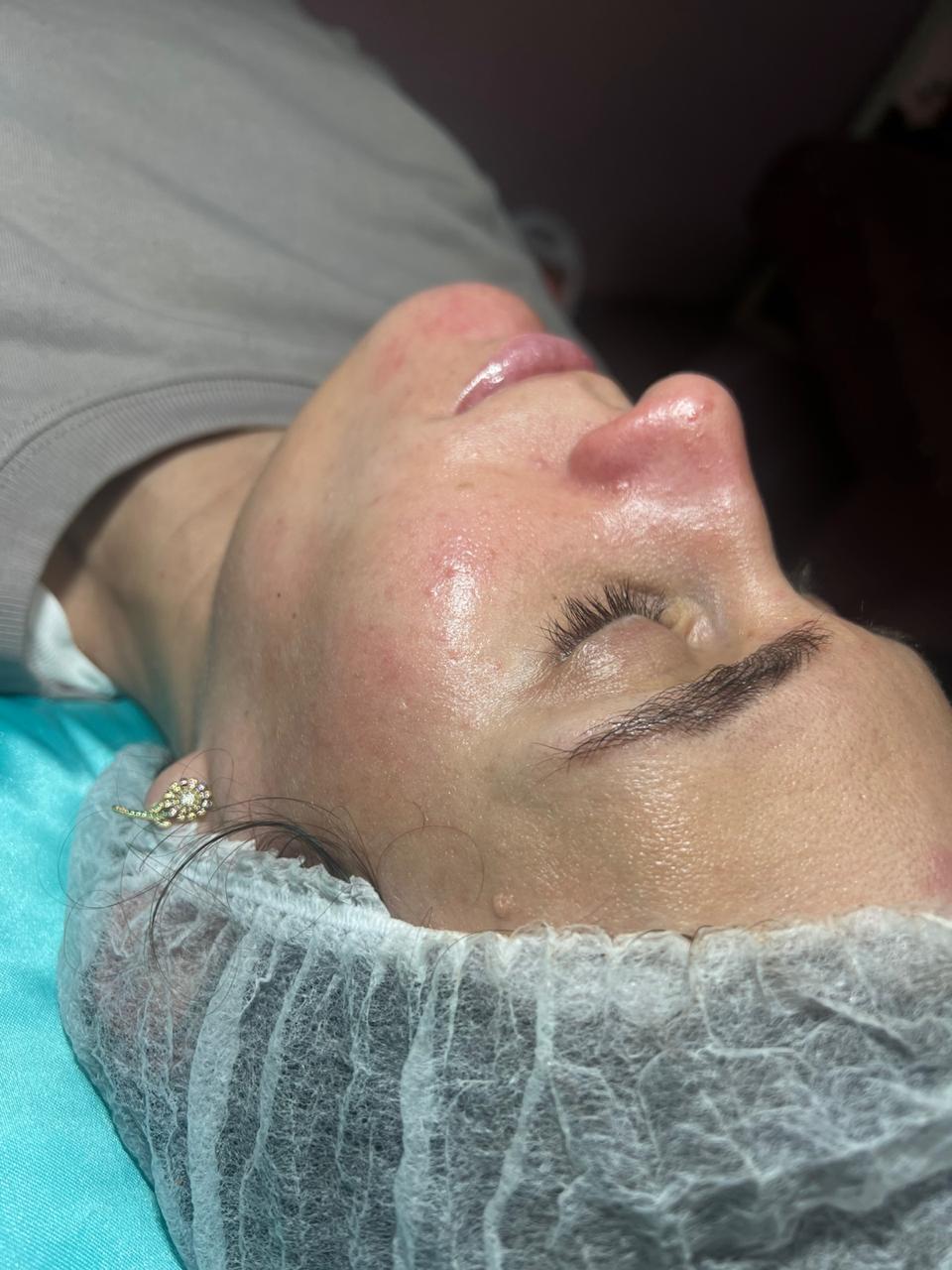 Trabajo realizado en Estética Pamela Rodriguez 33
