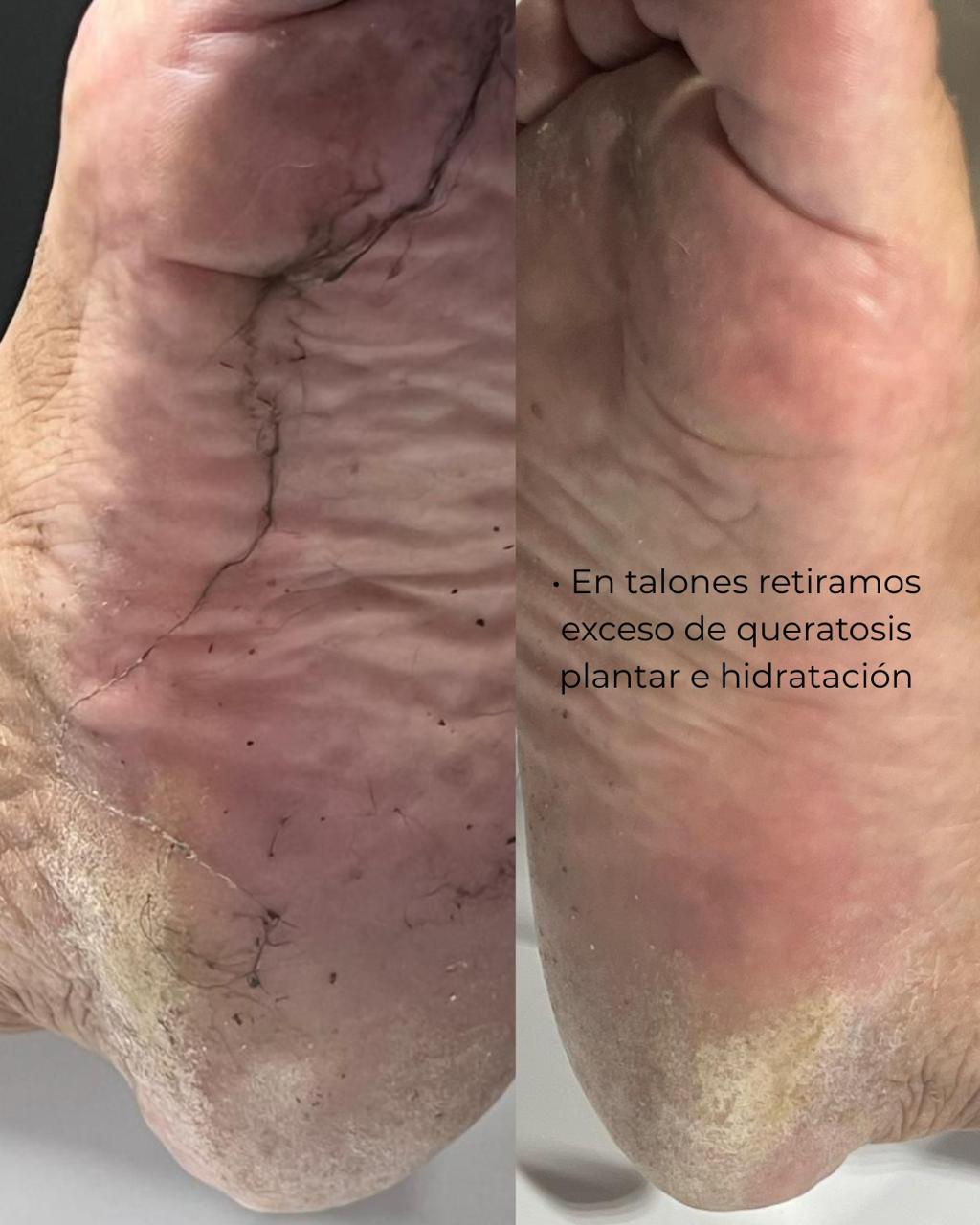 Trabajo realizado en Estética Pamela Rodriguez 34