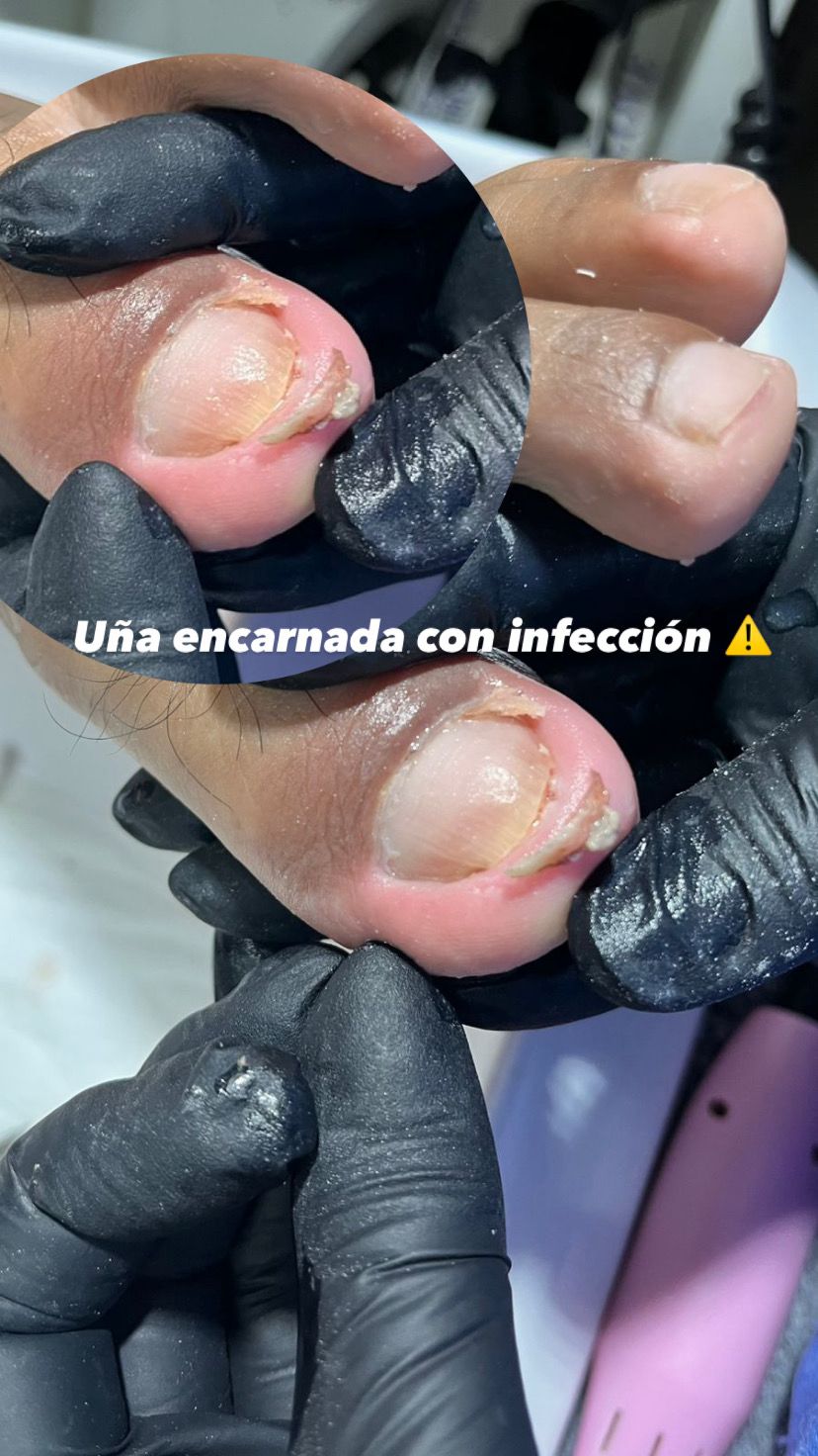 Trabajo realizado en Estética Pamela Rodriguez 35