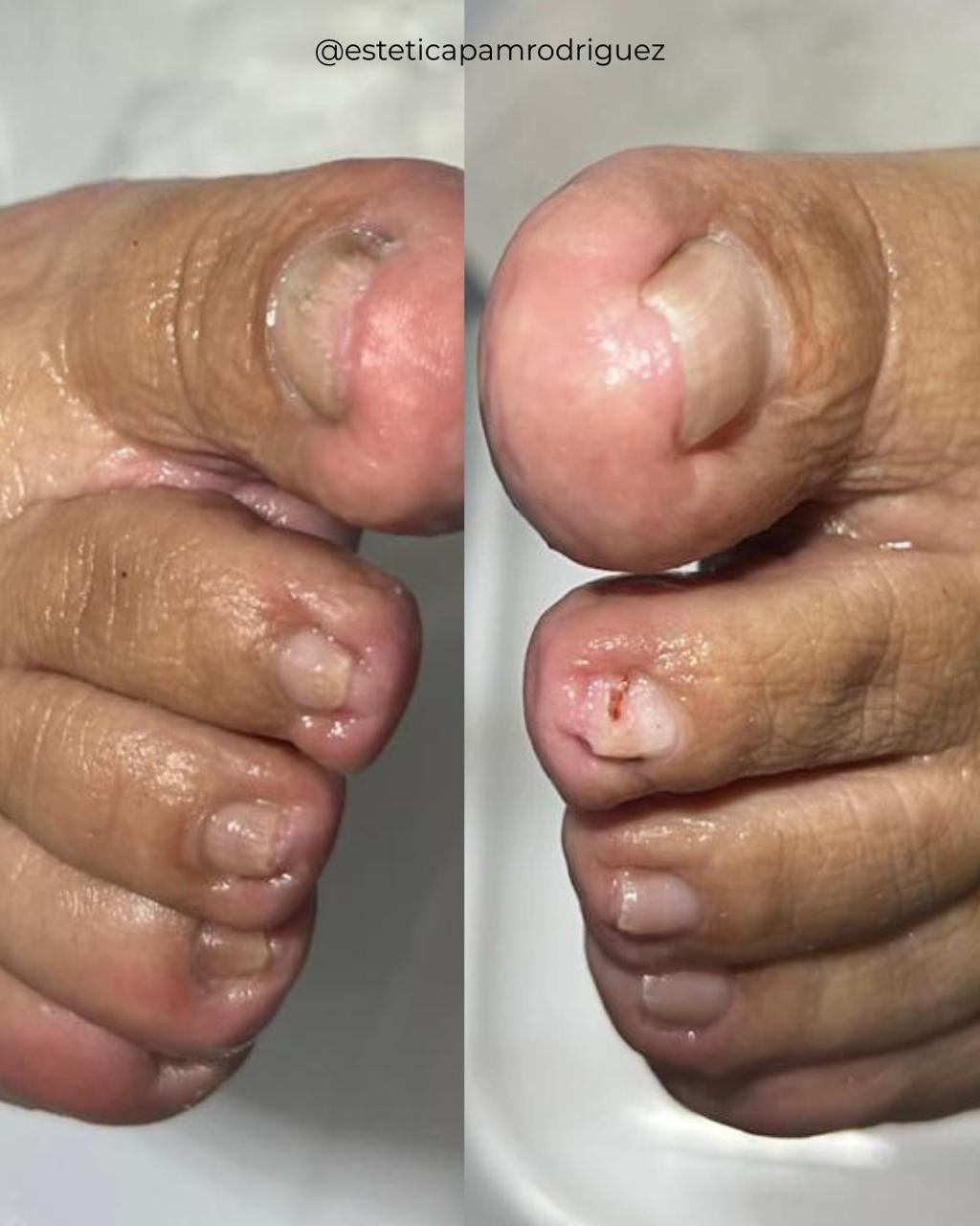 Trabajo realizado en Estética Pamela Rodriguez 36