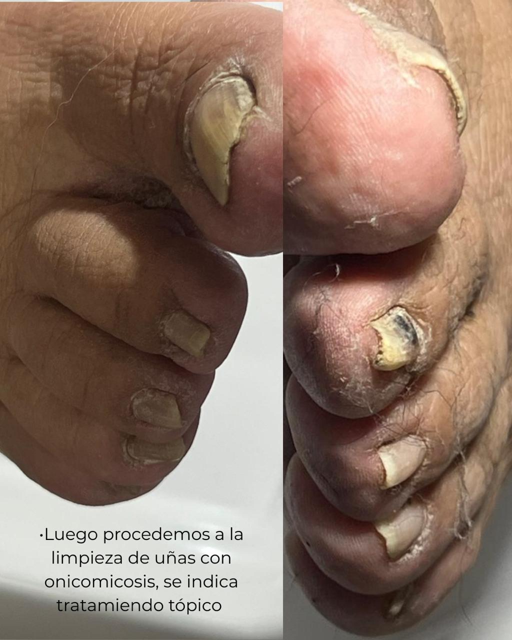 Trabajo realizado en Estética Pamela Rodriguez 38