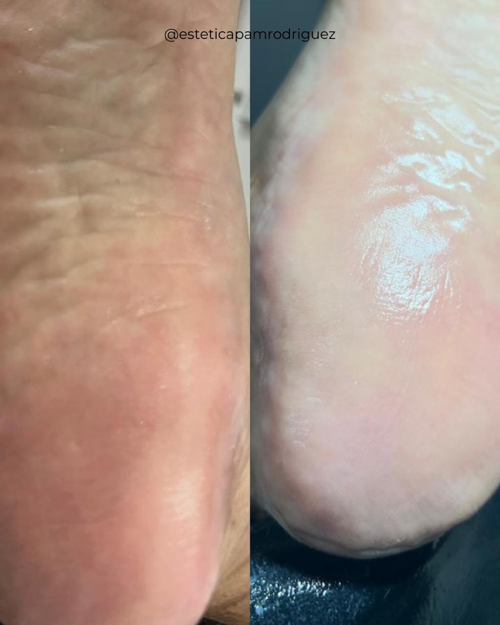 Trabajo realizado en Estética Pamela Rodriguez 40
