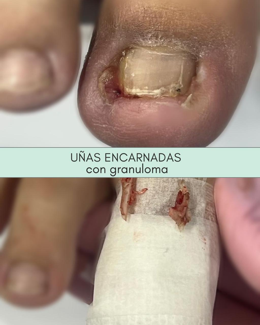 Trabajo realizado en Estética Pamela Rodriguez 41