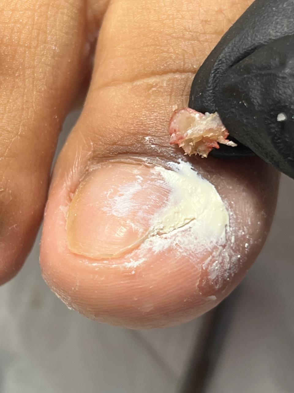 Trabajo realizado en Estética Pamela Rodriguez 42