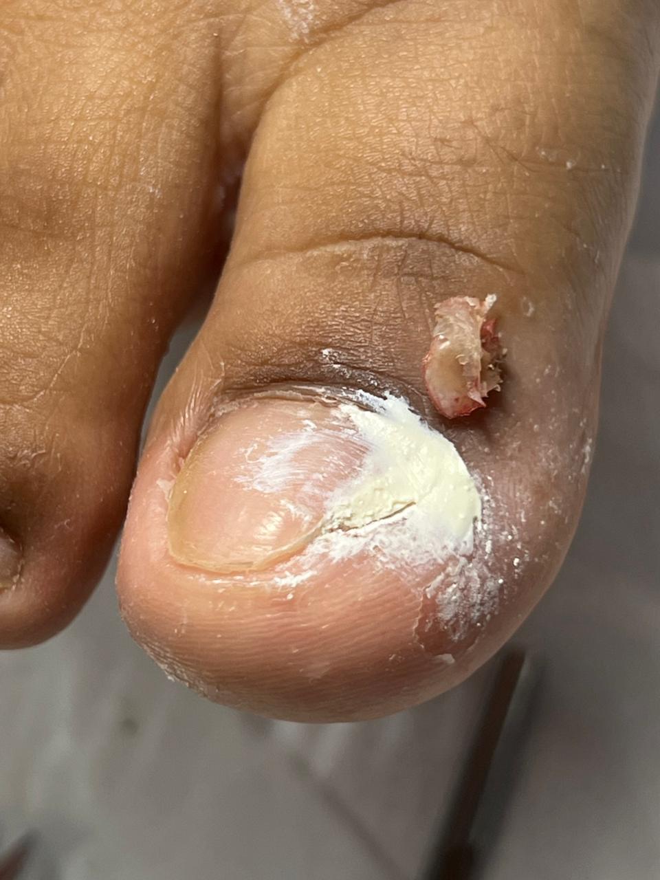 Trabajo realizado en Estética Pamela Rodriguez 43