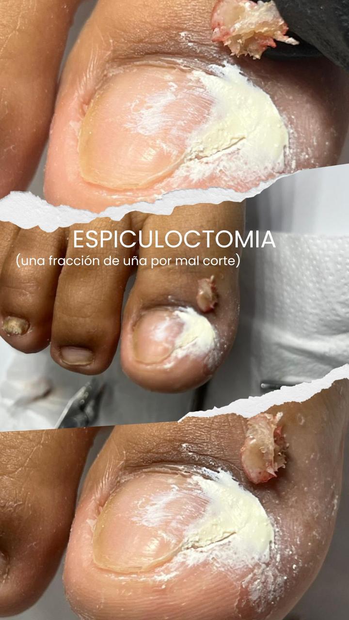 Trabajo realizado en Estética Pamela Rodriguez 44