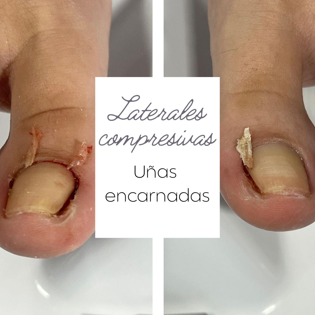Trabajo realizado en Estética Pamela Rodriguez 45