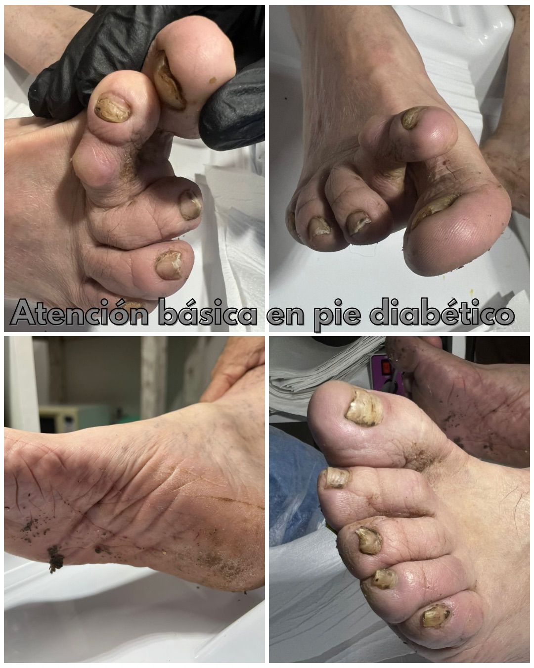 Trabajo realizado en Estética Pamela Rodriguez 46
