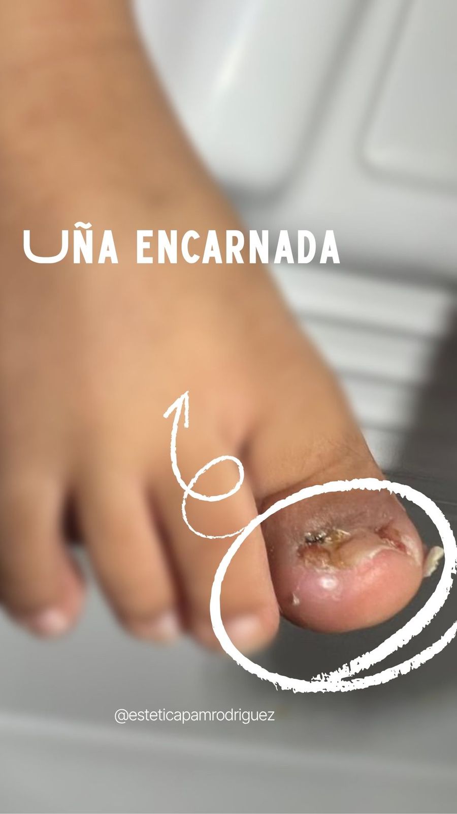 Trabajo realizado en Estética Pamela Rodriguez 47
