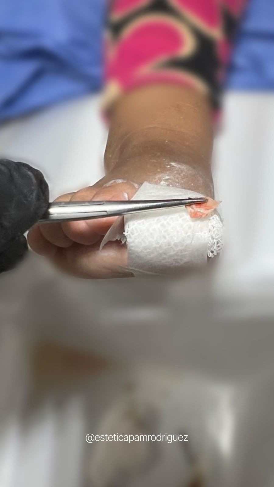 Trabajo realizado en Estética Pamela Rodriguez 48