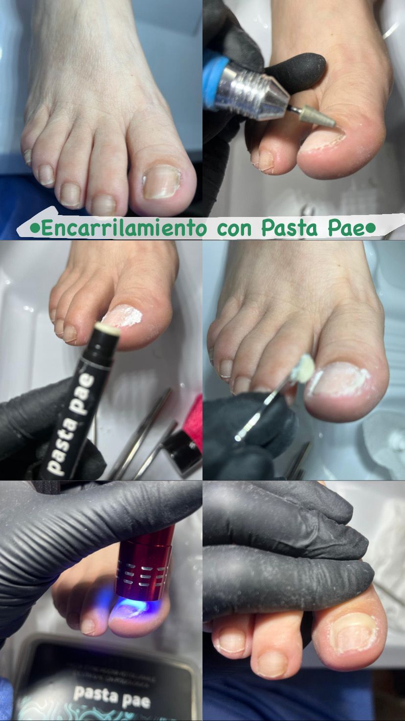 Trabajo realizado en Estética Pamela Rodriguez 50