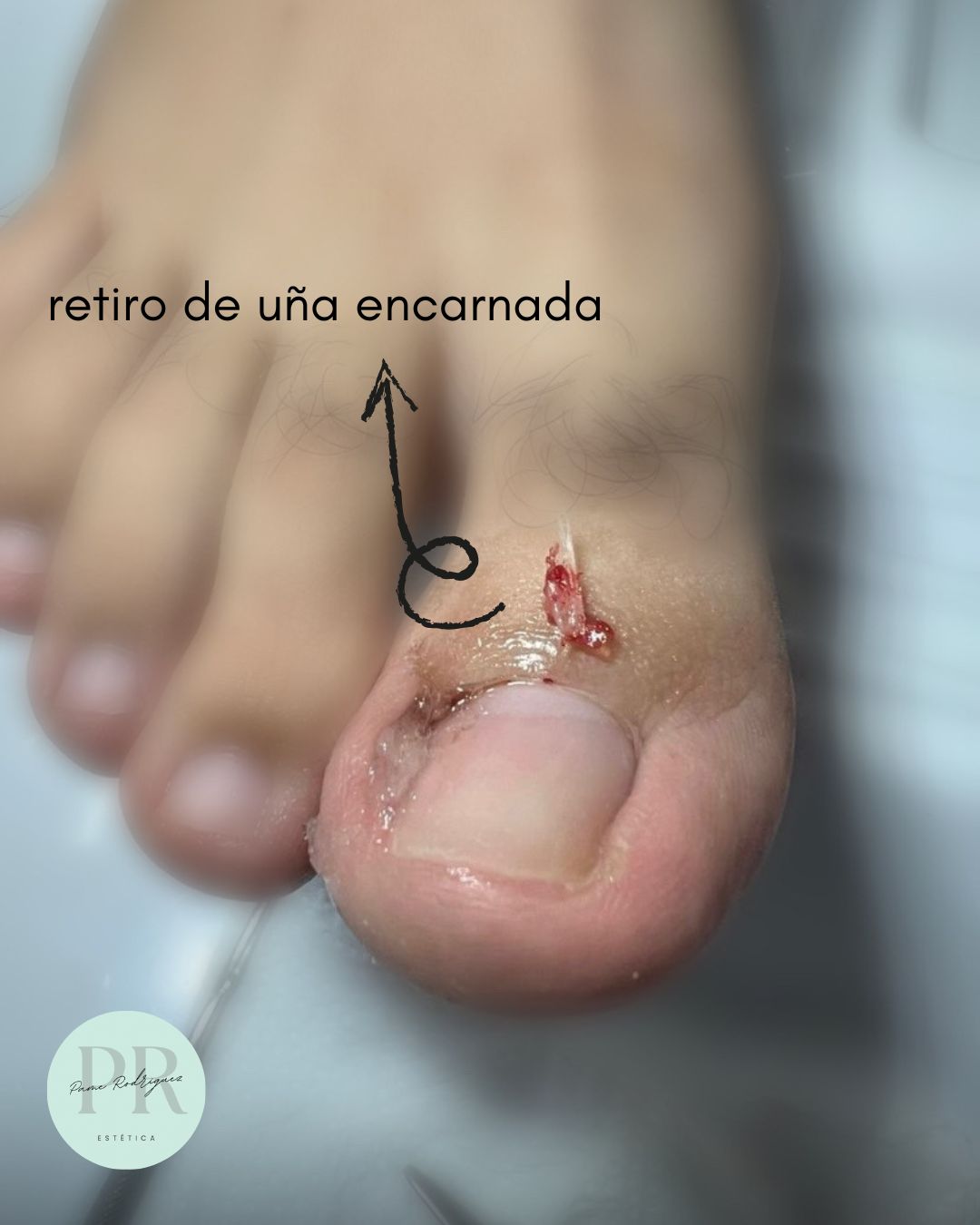Trabajo realizado en Estética Pamela Rodriguez 52