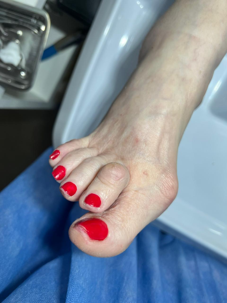 Trabajo realizado en Estética Pamela Rodriguez 53